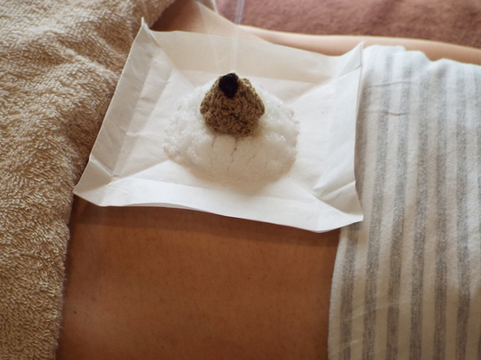 お腹の灸